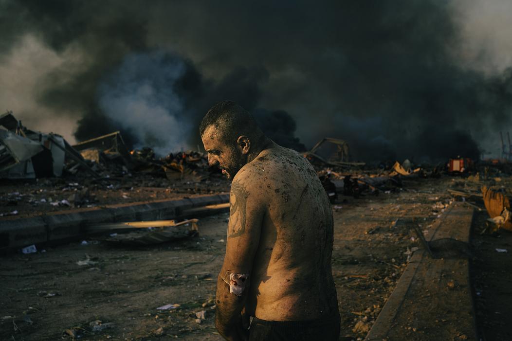 Pandemic, social justice, territorial conflicts: 2021 World Press Photo Contest nominees announced